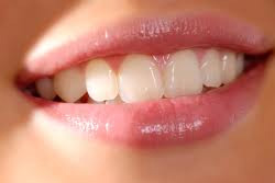 Porcelain Veneers & Cosmetic Bonding